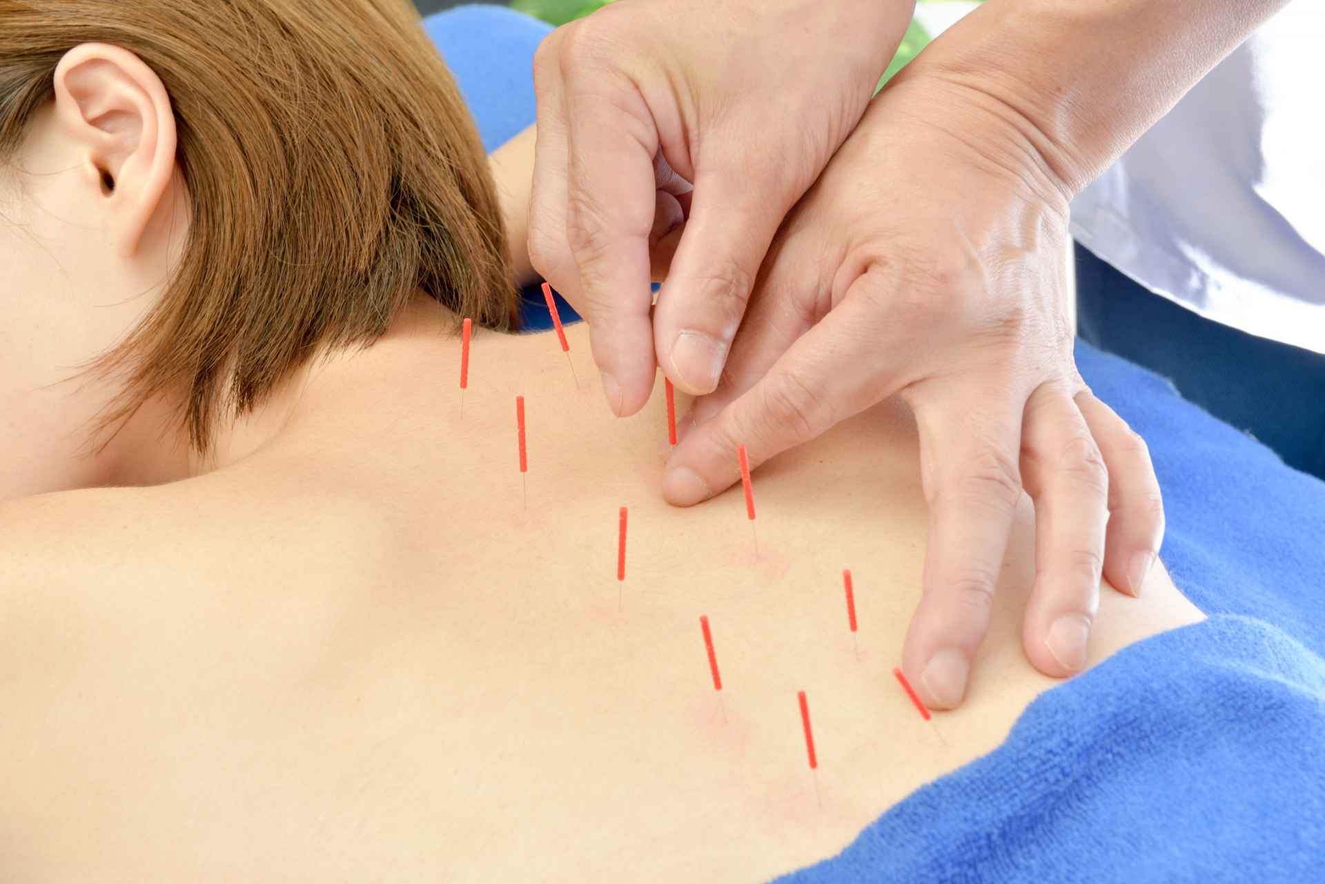 症状別鍼灸治療【No.3】